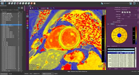 T Mapping Mapping Medisimaging