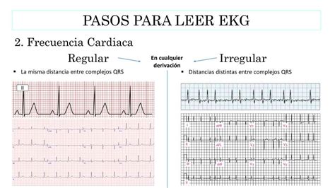 Frecuencia Cardiaca Ekg Doctorteco Udocz