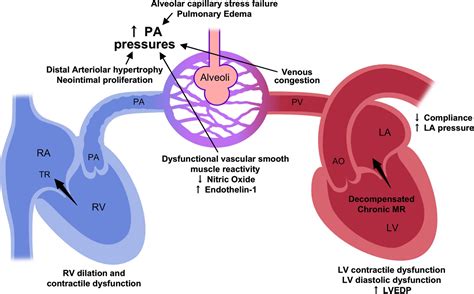 Hypertension As Related To Heart And Circulation Pictures