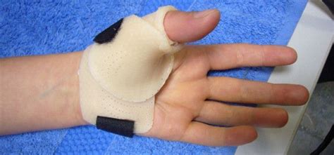 Short Thumb Spica Thumb Orthosis Short