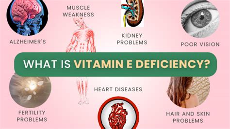 Un anumit cupru unpleasantly vitamin a deficiency symptoms Interpret ...