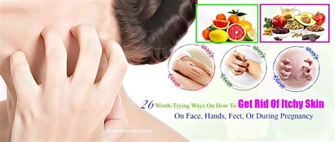 26 Ways How To Get Rid Of Itchy Skin On Face Or During Pregnancy