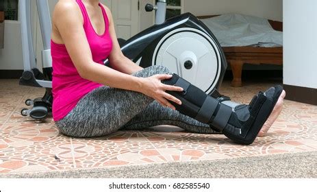 Broken Leg Short Leg Cast Splint Stock Photo Shutterstock