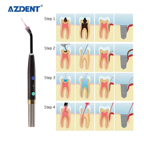 Azdent Dental Supply Photo Activated Disinfection Medical Low Level