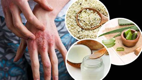 How To Treat Eczema Permanently The Impressive Blog 9796