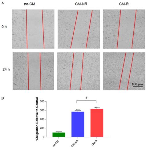 (A) Cell migration at 0 and 24 h after scratching (B) Quantitative ...