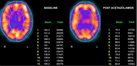 [figure Figure 2 Normal Examination In ] Statpearls Ncbi Bookshelf