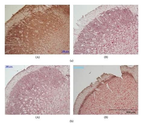 Effects Of The Lesion Of The C1 C2 Spinal Segments On C Fos Expression