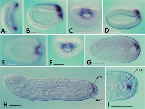 A I Expression Of Amphiwnt1 In Whole Mounts Of Amphioxus Embryos In Download Scientific