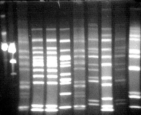 Pulsed Field Gel Electrophoretic Restriction Patterns Of Chromosomal