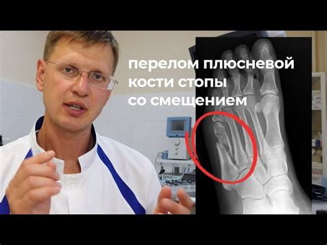 Ортезы при переломе плюсневой кости рекомендации и виды ортезов
