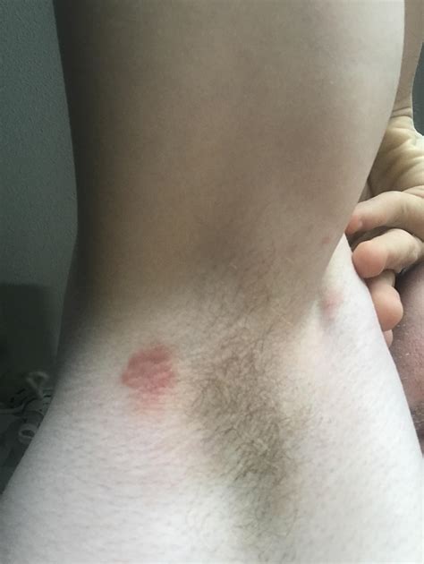 What’s in my armpit? It’s been here for three weeks. The other armpit