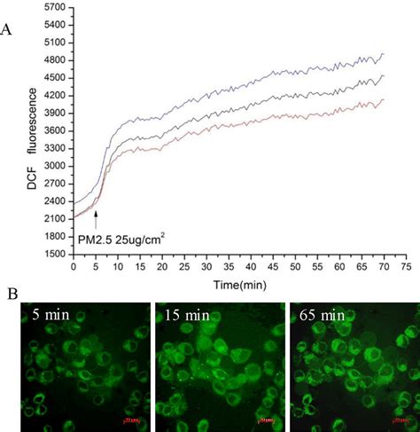 PM2 5 Induces ROS Generation In 16HBE Cells The Cells Were Incubated