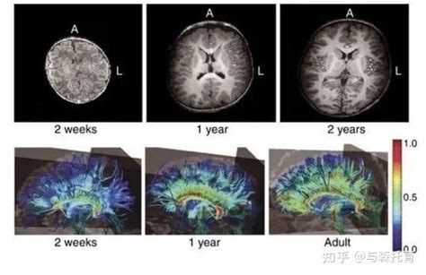 孩子一生仅一次大脑发育高峰期，父母千万要抓住，错过不可逆！ 知乎