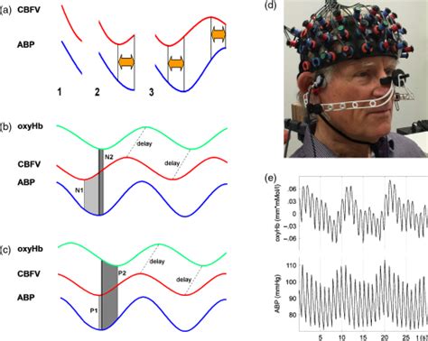 Spatial Mapping Of Dynamic Cerebral Autoregulation By Multichannel Near