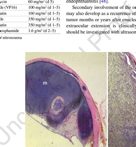 Gross And Histopathologic Photographs Showing The Extension Of