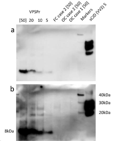 Western Blot Analysis Of Prp Res In Frontal Cortex Fc Or Occipital