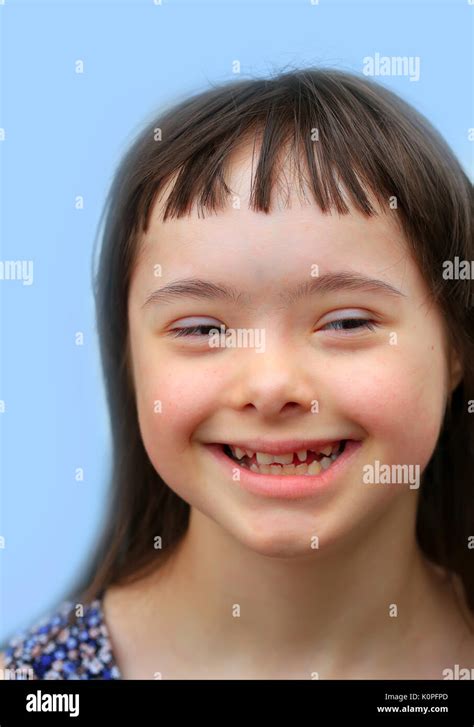 Down Syndrome Girl Fotos Und Bildmaterial In Hoher Auflösung Alamy