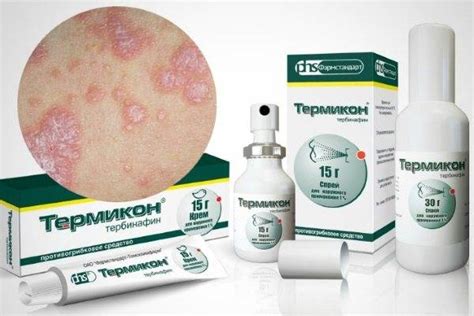 Топ 32 мази и кремы от лишая: самые эффективные препараты
