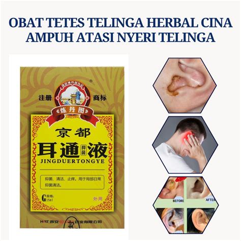 Jual Obat Tetes Telinga Congek Bernanah Bau Busuk Curek Telinga Gatal