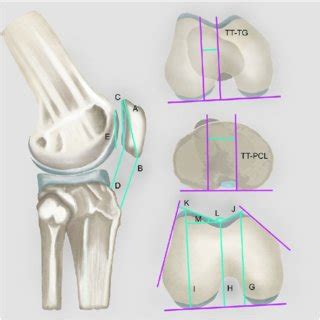 Patellofemoral Joint Anatomy