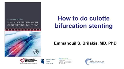 How To Do Culotte Bifurcation Stenting Youtube