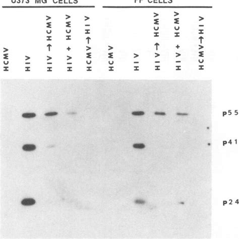 Effect Of Timing Of HCMV Infection On HIV Protein Synthesis U373 MG