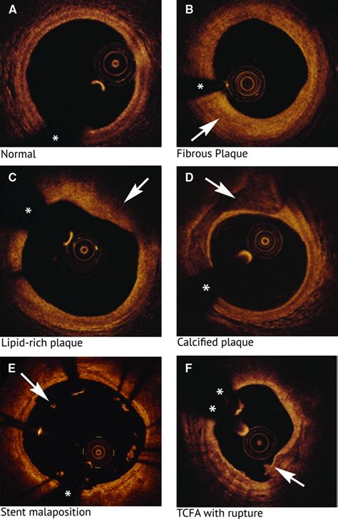 Optical Coherence Tomography Circulation