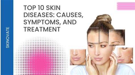 Top 10 Skin Diseases: Causes, Symptoms, and Treatment