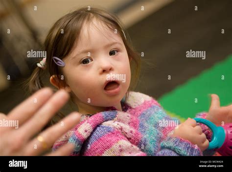 Toddler Girl With Downs Syndrome Stock Photo Alamy