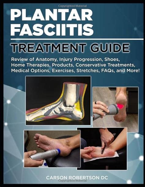 How To Self Treat Plantar Fasciitis The Physical Therapy Advisor Atelier Yuwaciaojp