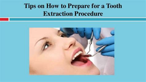 Tips On How To Prepare For A Tooth Extraction Procedure