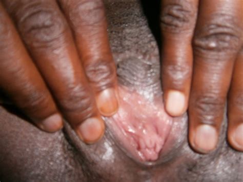 Female Circumcision 70 Photos Porn