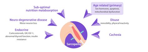 What Is Sarcopenia Physiotherapy Centre