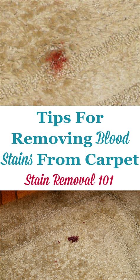 How To Remove Old Blood Stains On Carpet