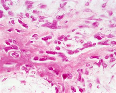 Histology Of The Bone