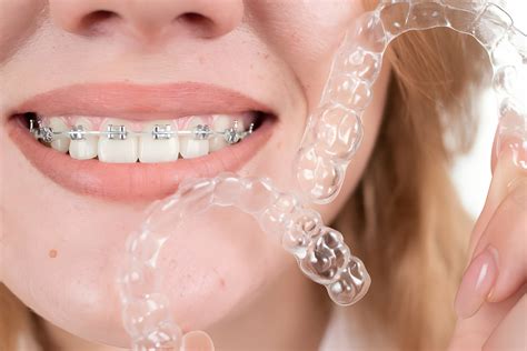 How Does Invisalign Work A Comprehensive Guide