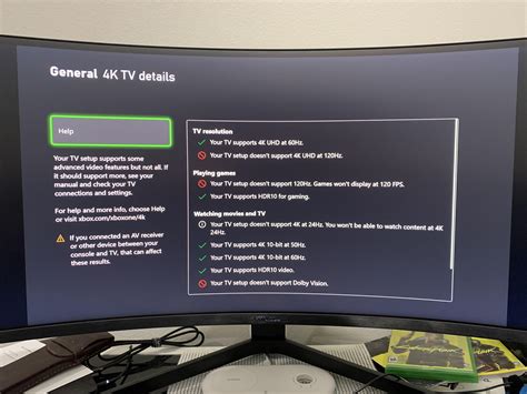 Xbox Series X 1440p Monitor Vast Selection Library Ecosystem Build