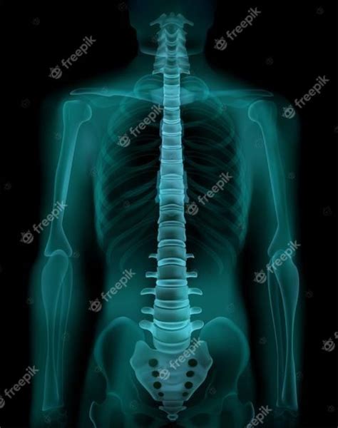 Columna Vertebral Humana Y Pelvis Radiograf A Ct Realista Imagen De