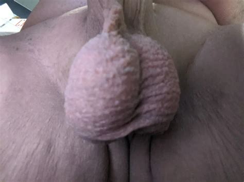 Ball Pictures Hurting Balls Need A Relief Nude Pics XHamster