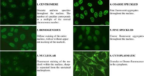 Different Types Of Staining