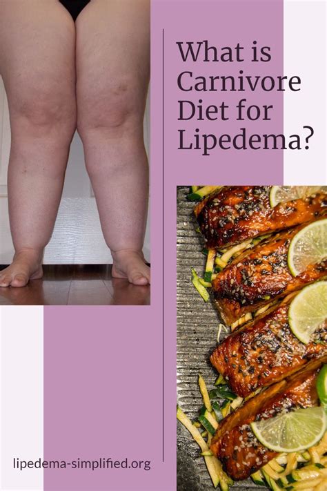 What is Carnivore Diet for Lipedema? | Lipedema diet, Lipedema ...