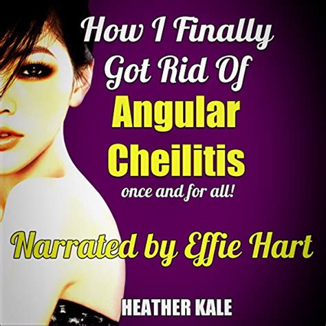 How I Finally Got Rid Of Angular Cheilitis Once And For All