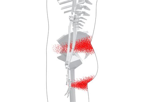 Quadratus Lumborum Trigger Points Overview Self Treatment