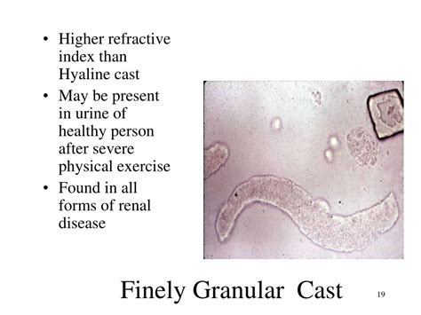 PPT - URINALYSIS PowerPoint Presentation, free download - ID:1077713