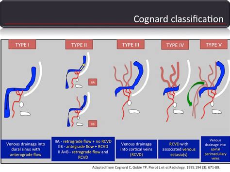 Figure 2 from Tips and tricks you should know to suspect a dural ...