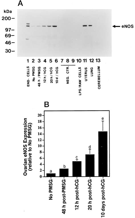 A Representative Western Blot Of Enos Protein In Rat Ovaries During Download Scientific