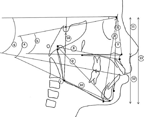 Skeletal Parameters A Angular Measurements In Degrees 1 Sna 2 Download Scientific