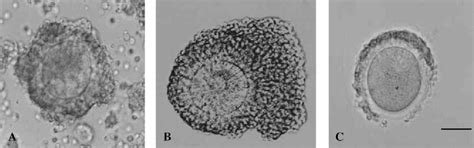 Figure From Correlation Between In Vitro Maturation And Expression Of