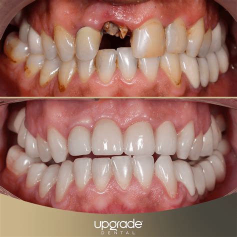 Galerie Foto Radiologie I Imagistic Dentar Upgrade Dental